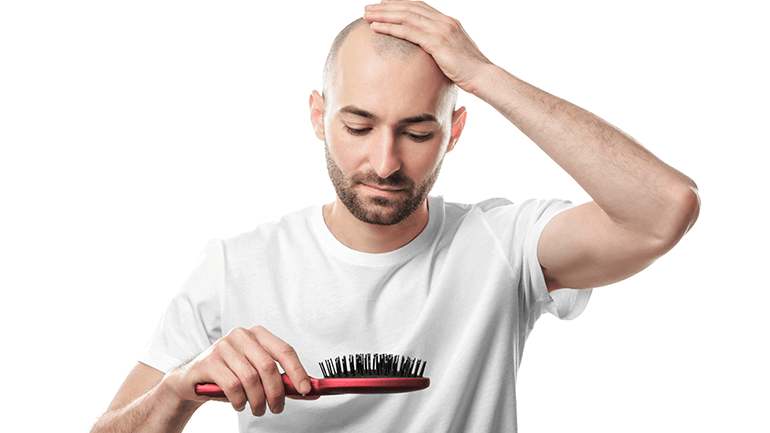How to Prevent Male Pattern Hair loss